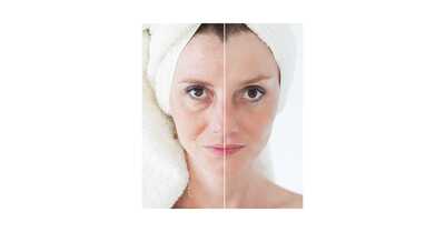 anti-aging, wellness, quad cities ketamine clinic